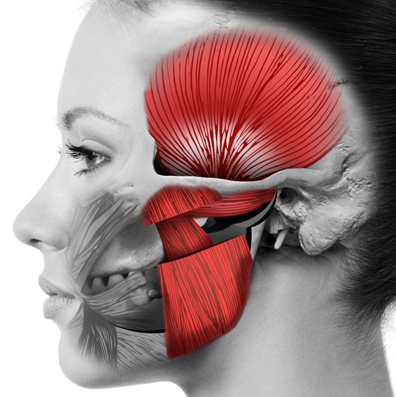 The MyoRelief Method