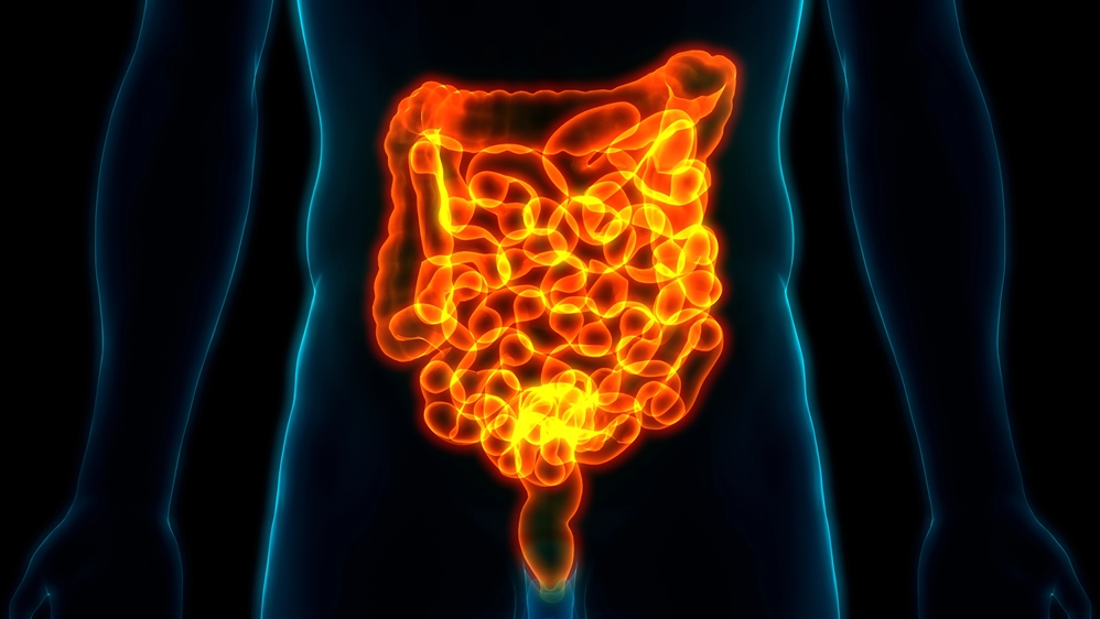 Post-Infectious IBS: IBS After Food Poisoning or a Stomach Bug