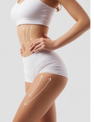 Woman’s midsection and thighs with treatment markings, illustrating body contouring and Vaser liposuction recovery results Woman’s midsection and thighs with treatment markings, illustrating body contouring and Vaser liposuction recovery results