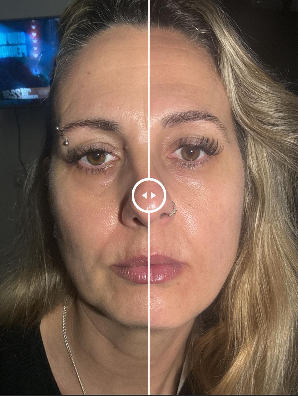 Resultado antes y después 2