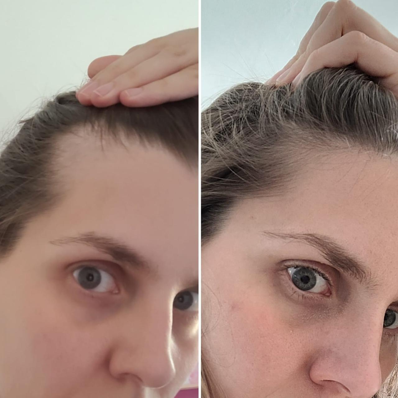 Resultado antes y después 3