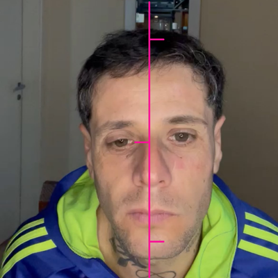 Resultado de Emilio con Planchita para arrugas