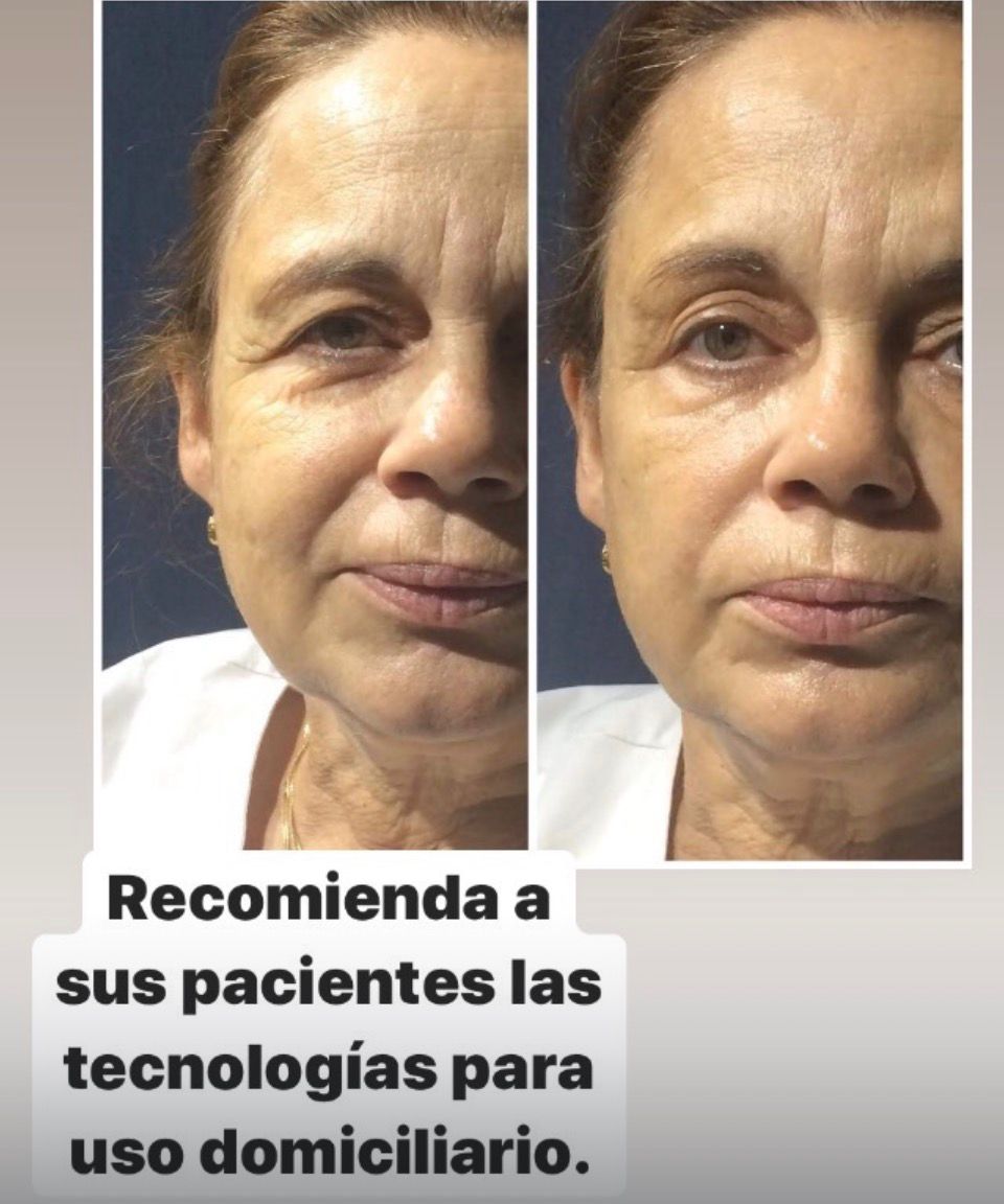 Resultado de Marina con Planchita para arrugas
