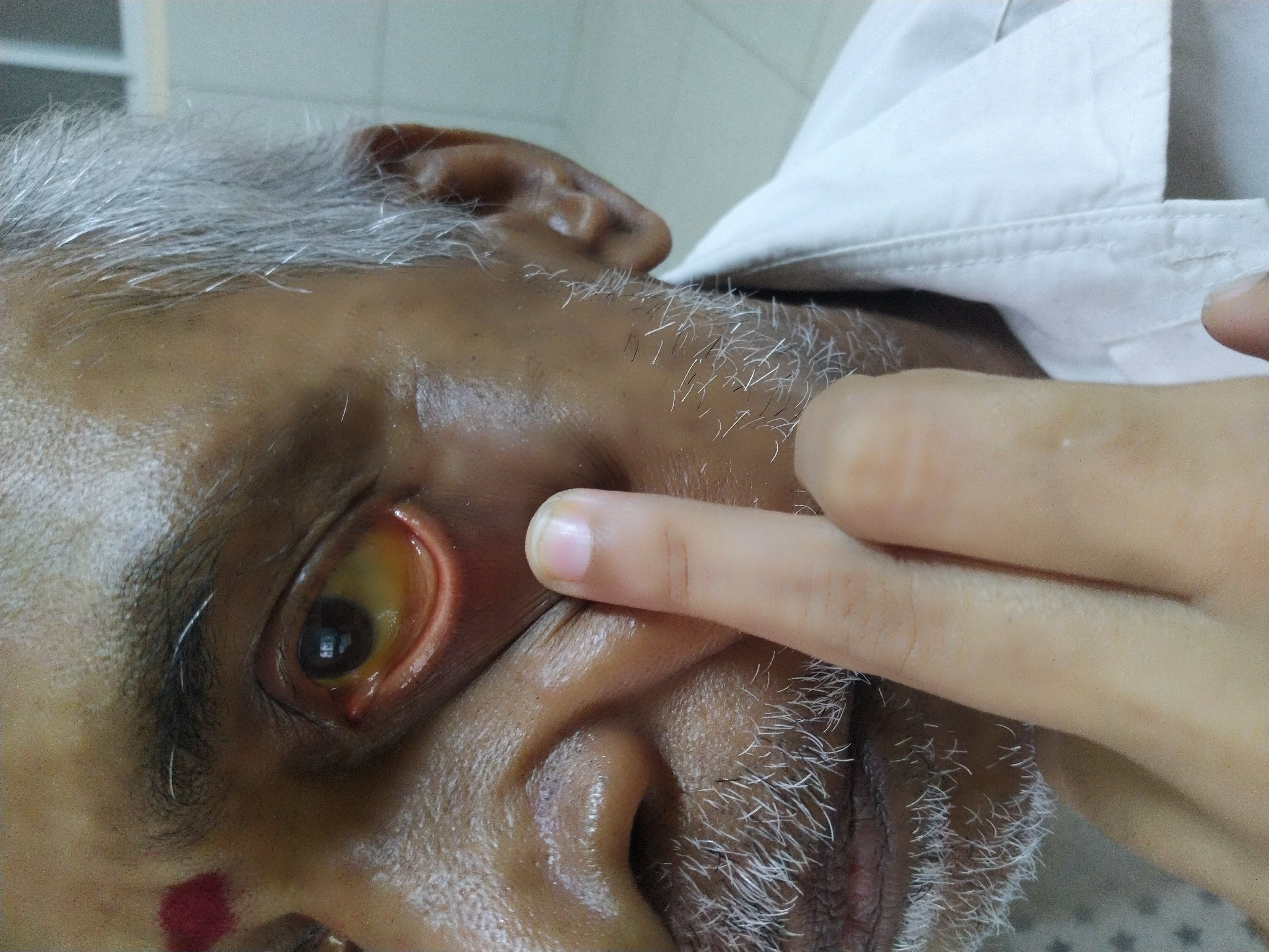 Liver Health & Jaundice Recovery (Kamala) - after