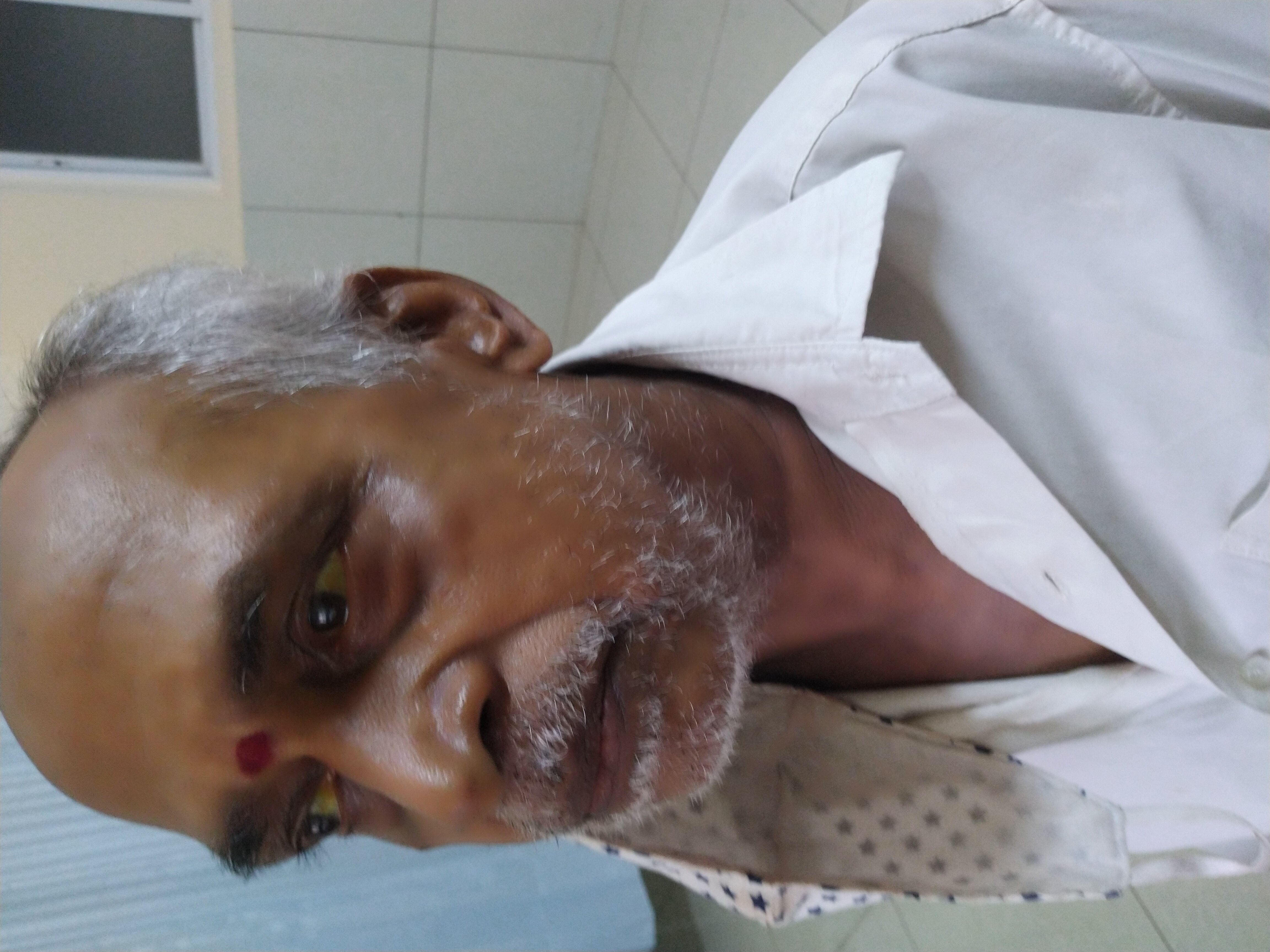 Liver Health & Jaundice Recovery (Kamala) - before