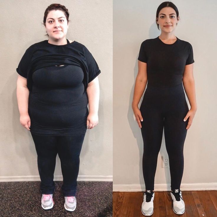 Patient before and after weight loss transformation