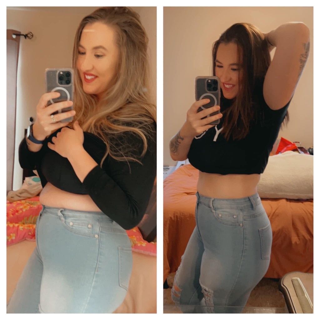 Patient before and after weight loss transformation