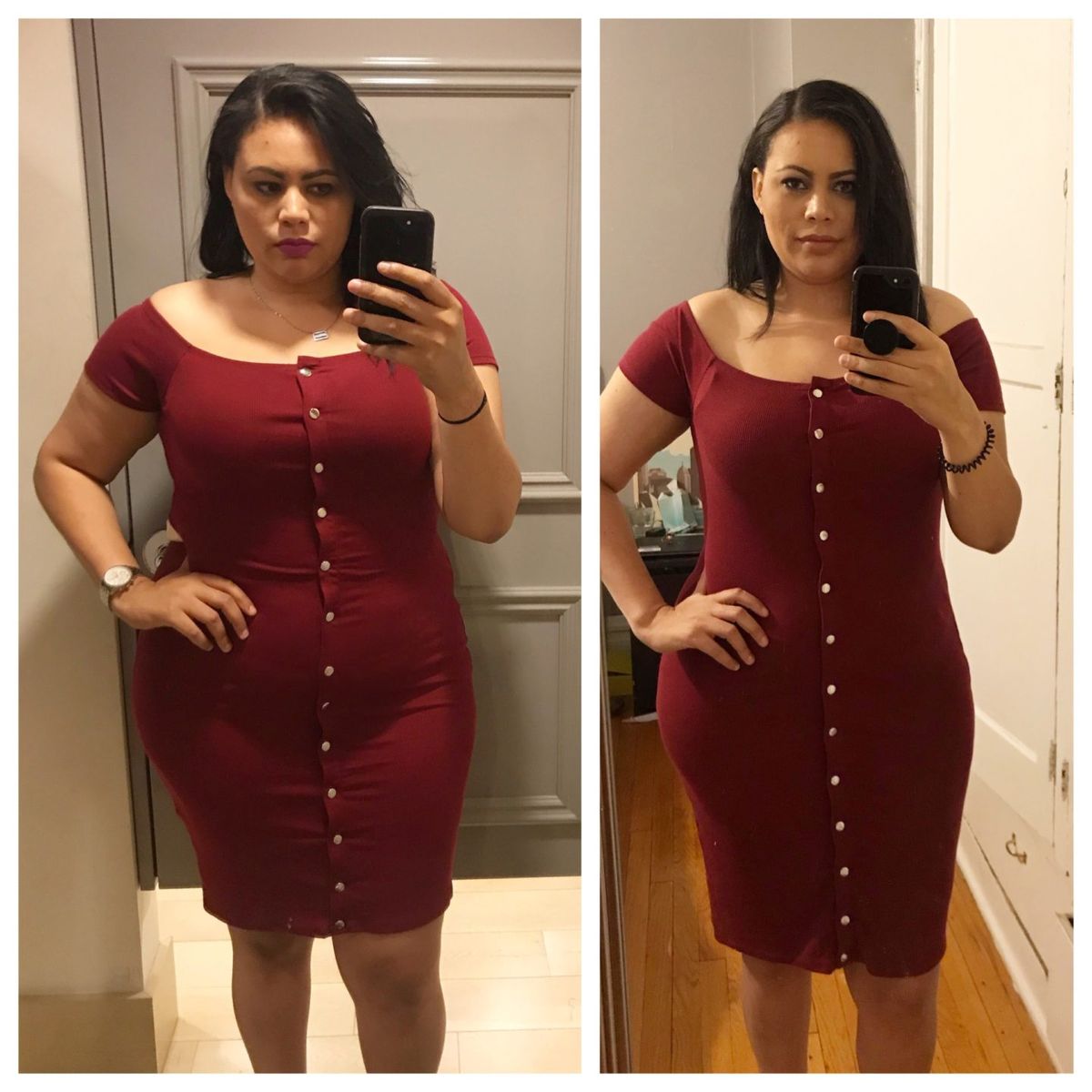 Patient before and after weight loss transformation