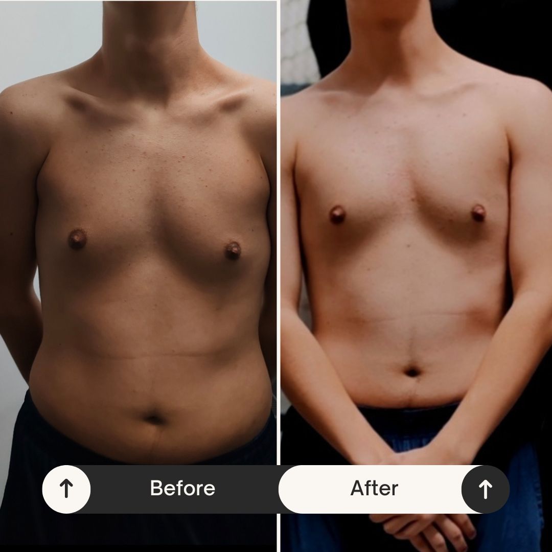 Rezultat transformare