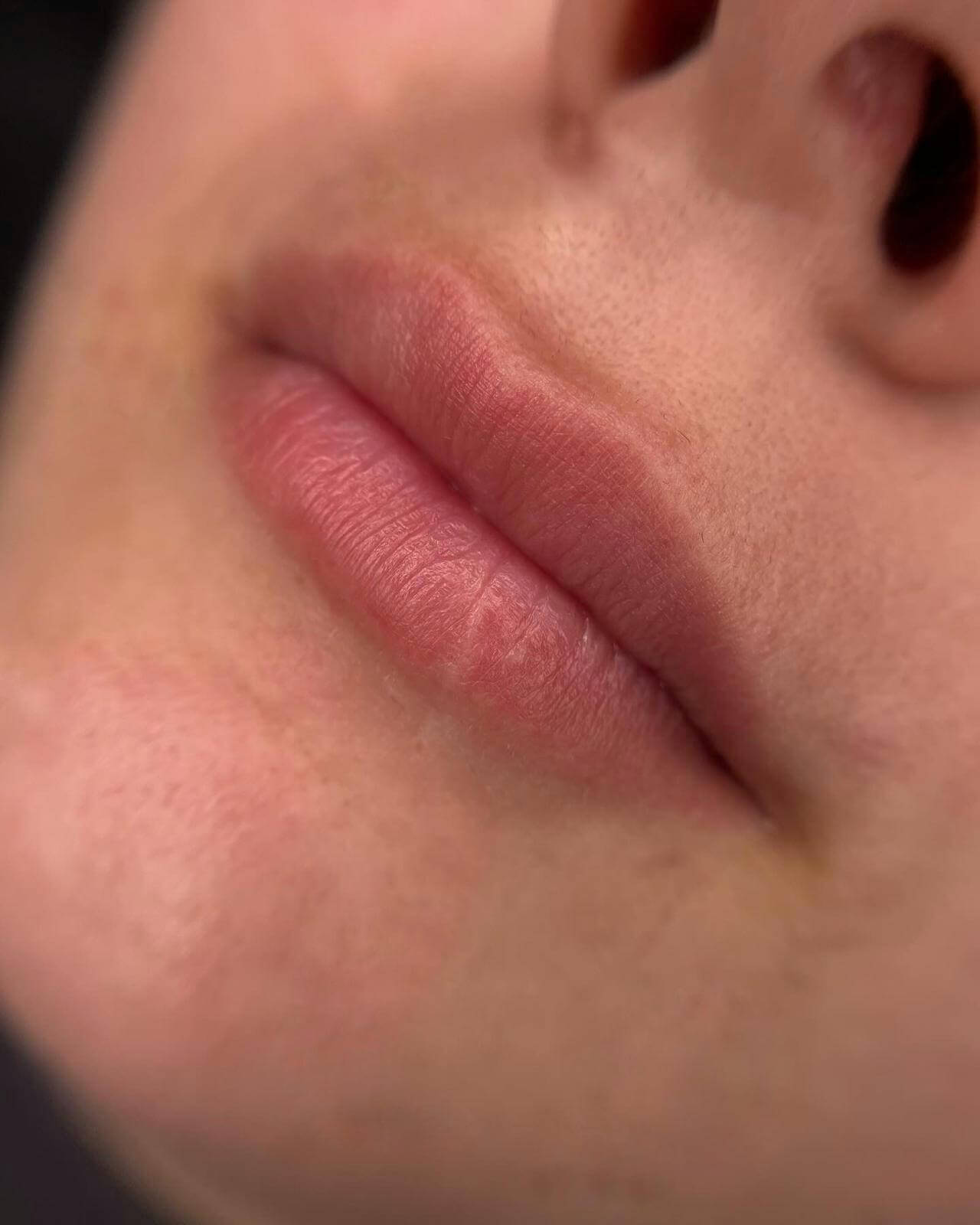Unbearbeitete Lippen vor der PMU-Behandlung – natürliche Lippenform ohne Pigmentiert