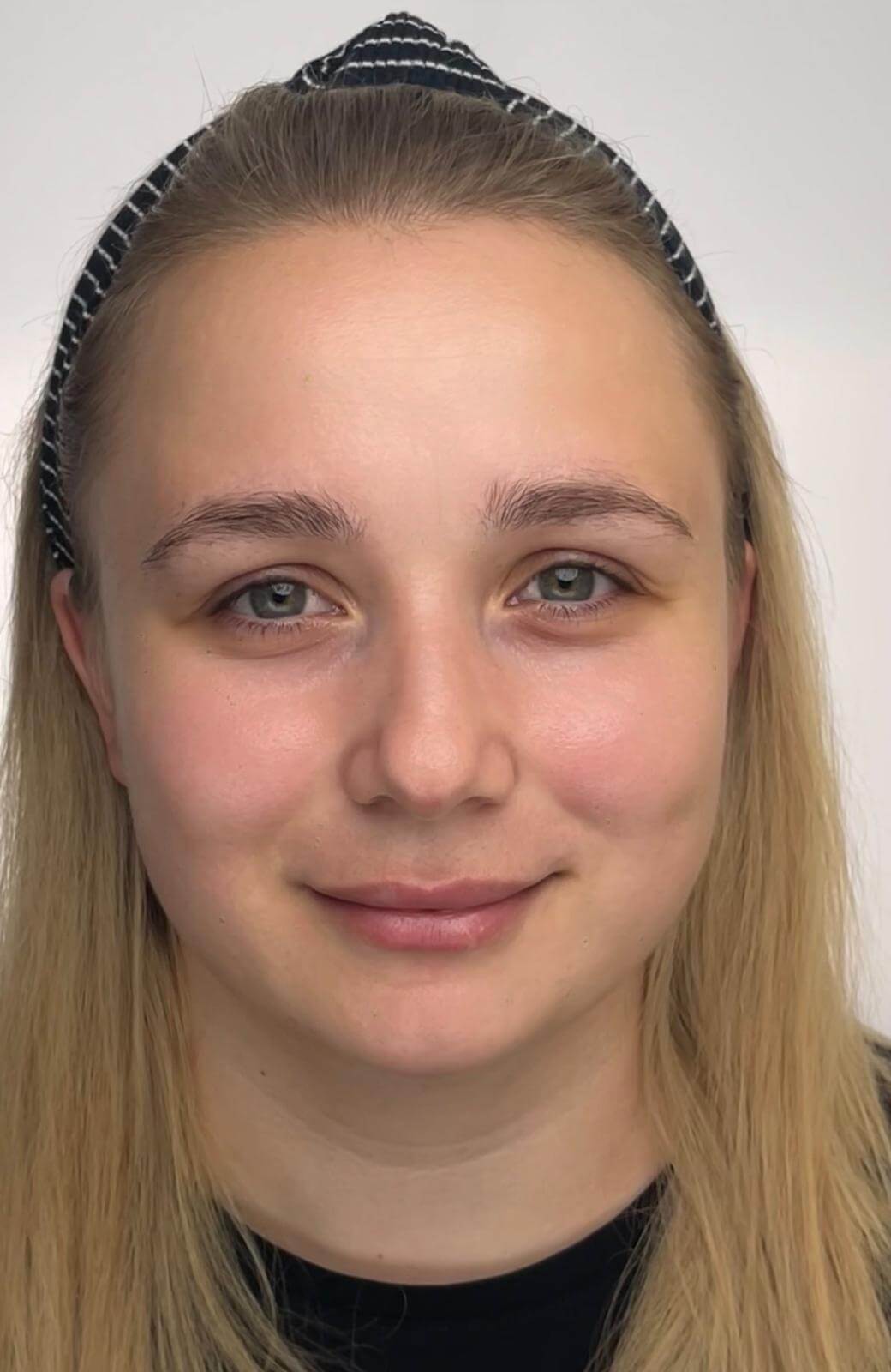 Ungeschminktes Portrait einer Kundin vor der Behandlung – natürliche Schönheit im Fokus