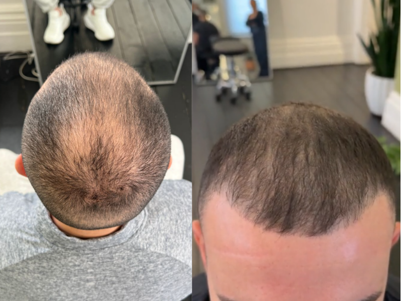 Before treatment