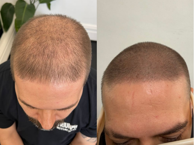 Before treatment