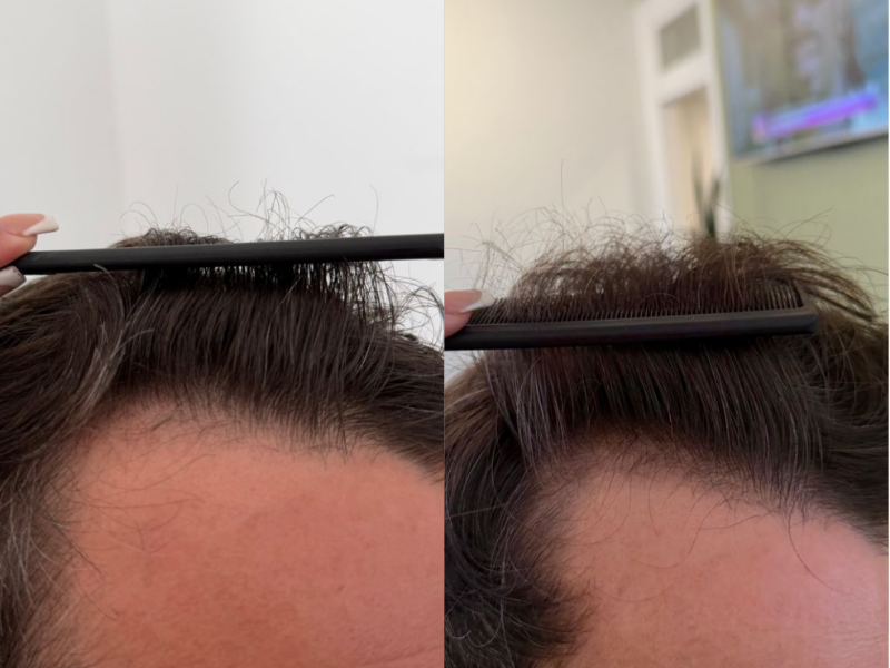 Before treatment