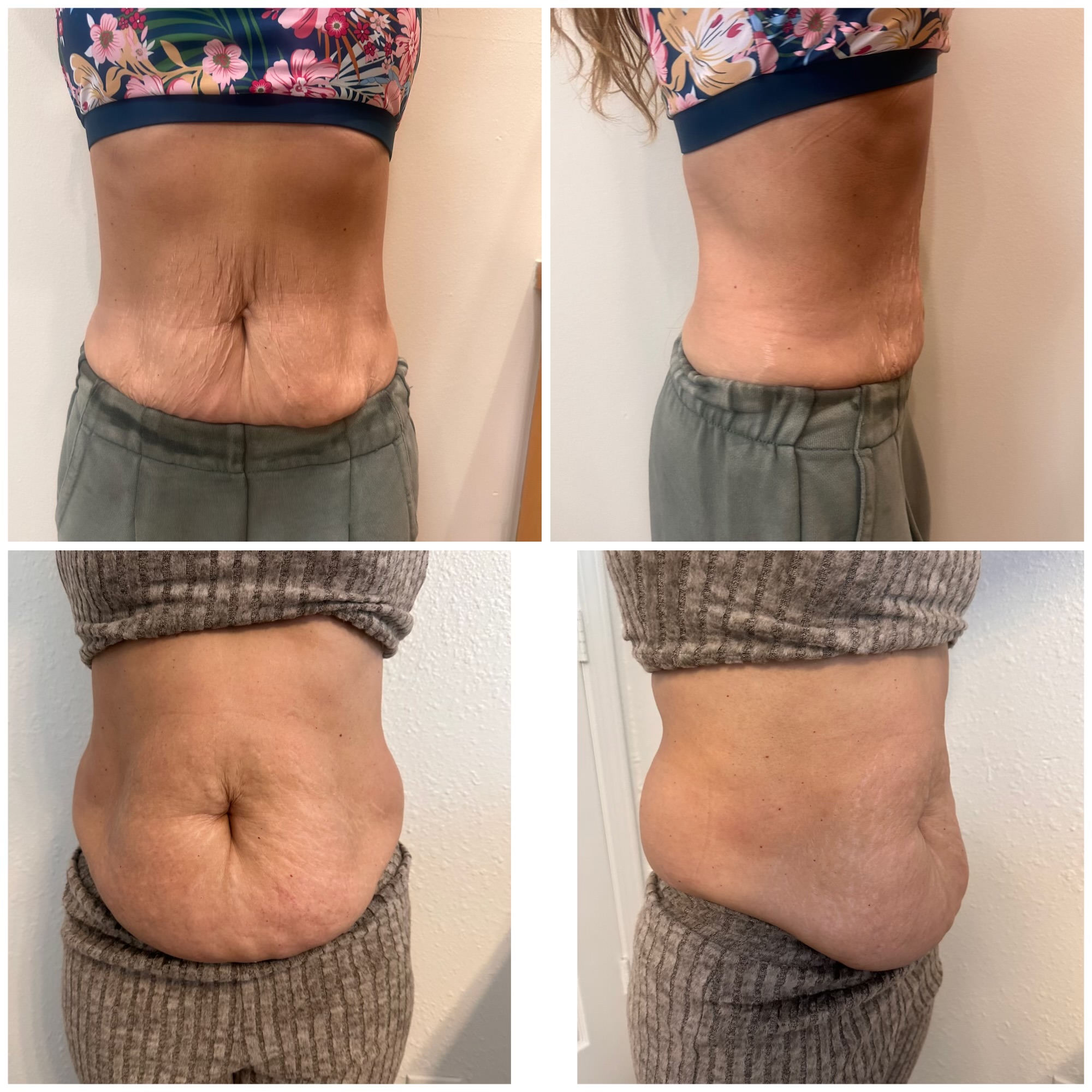 Before and after transformation results