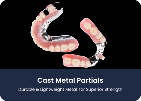 Cast Metal Partials