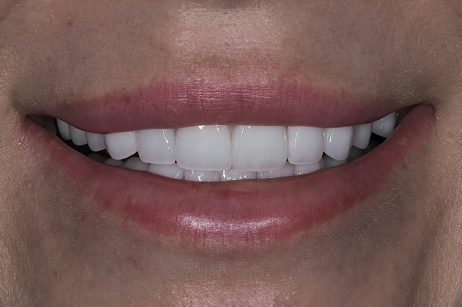 Smile before treatment