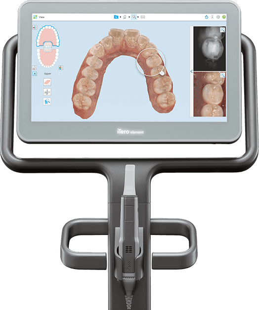 Escáner intraoral iTero — diagnóstico digital 3D en SmileTech Bogotá