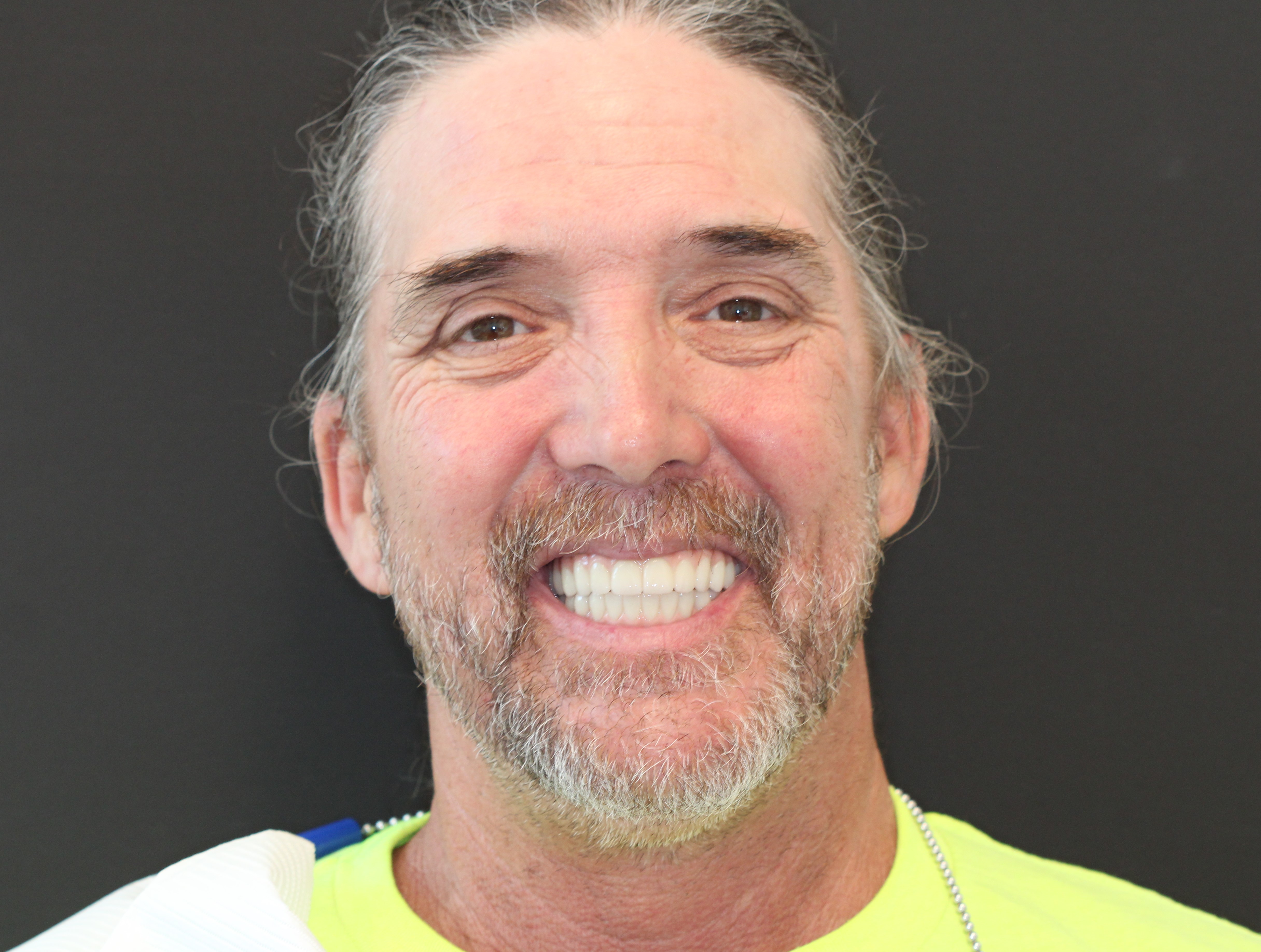 Patient smile after dental implant treatment