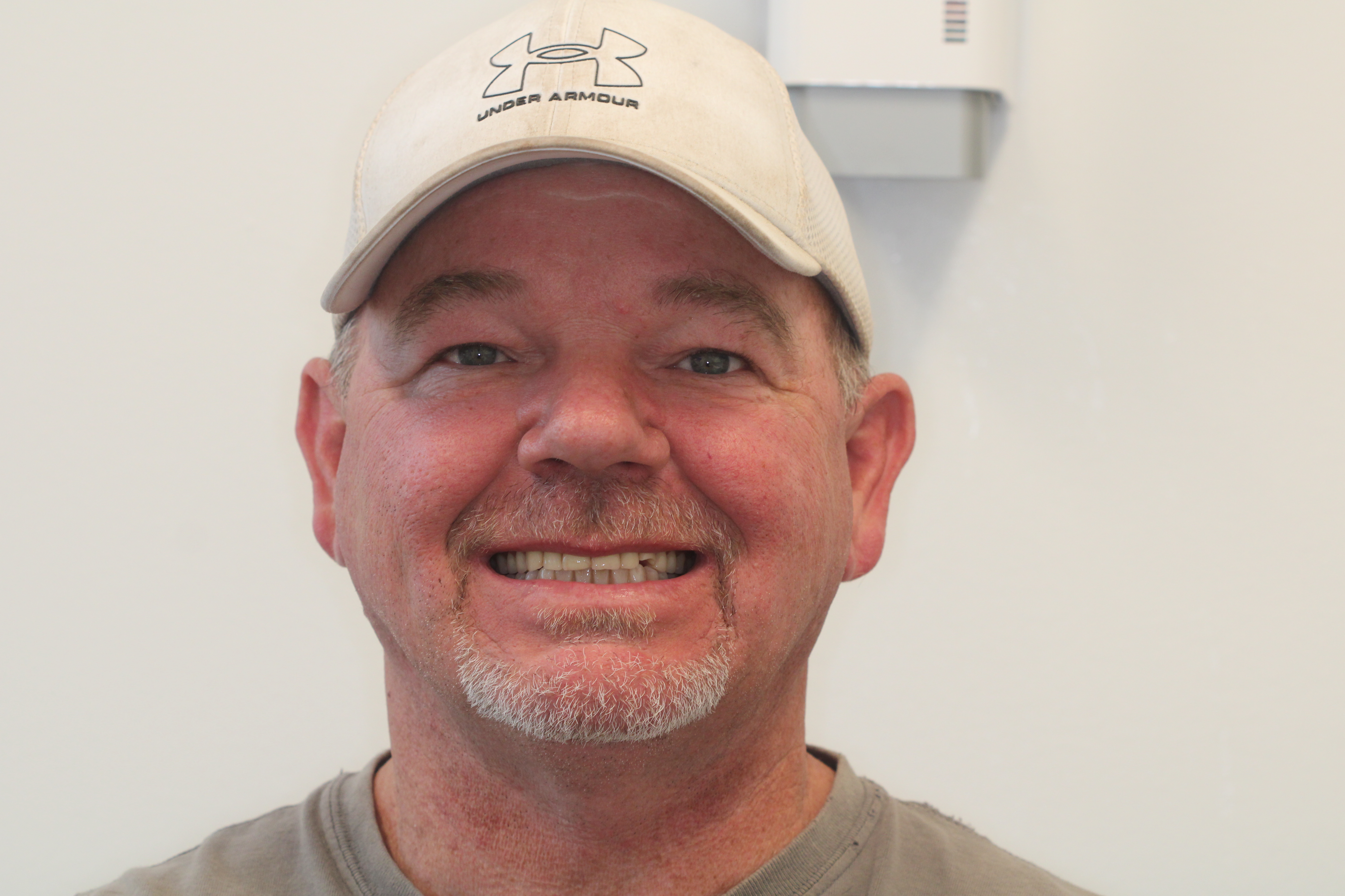 Patient smile after dental implant treatment