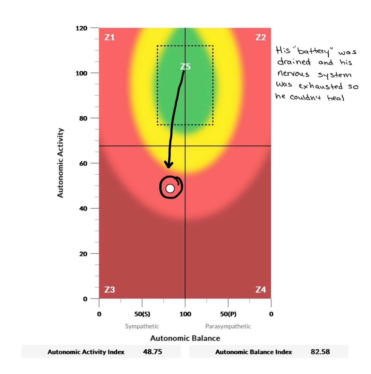 Liam's nervous system scan before care