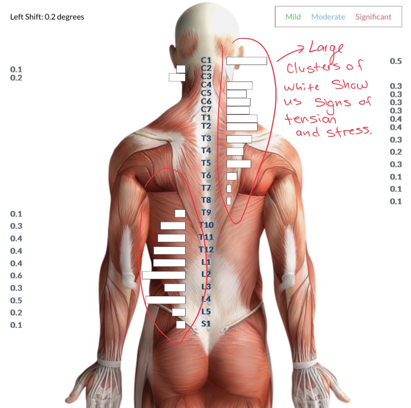 Caleb's nervous system scan before care