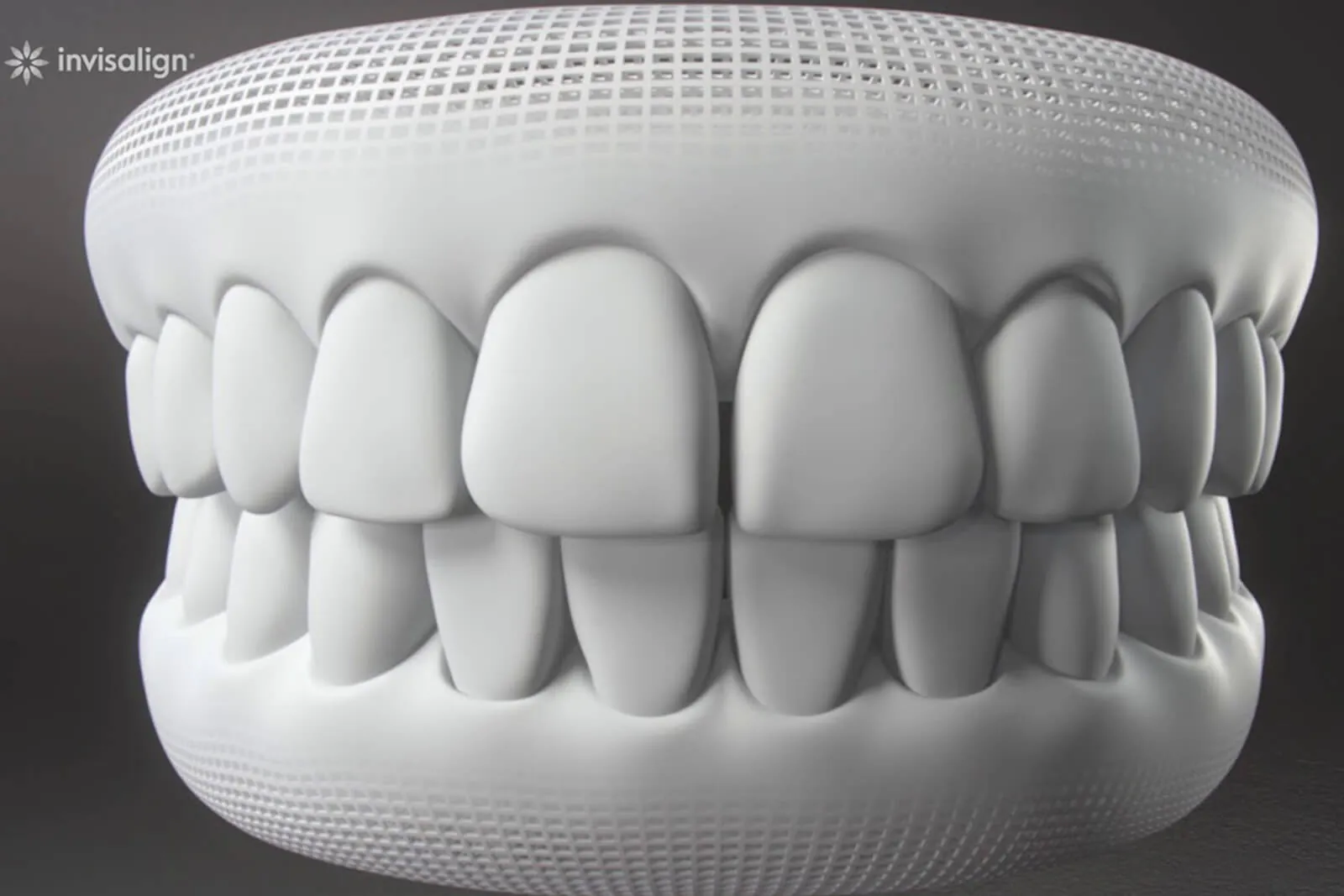 3D model of teeth wearing clear aligners
