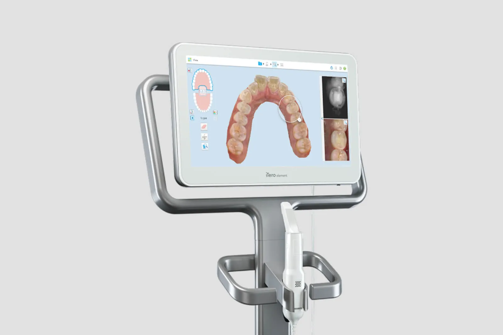 Digital intraoral scanner showing a 3D scan of teeth, used at first visits