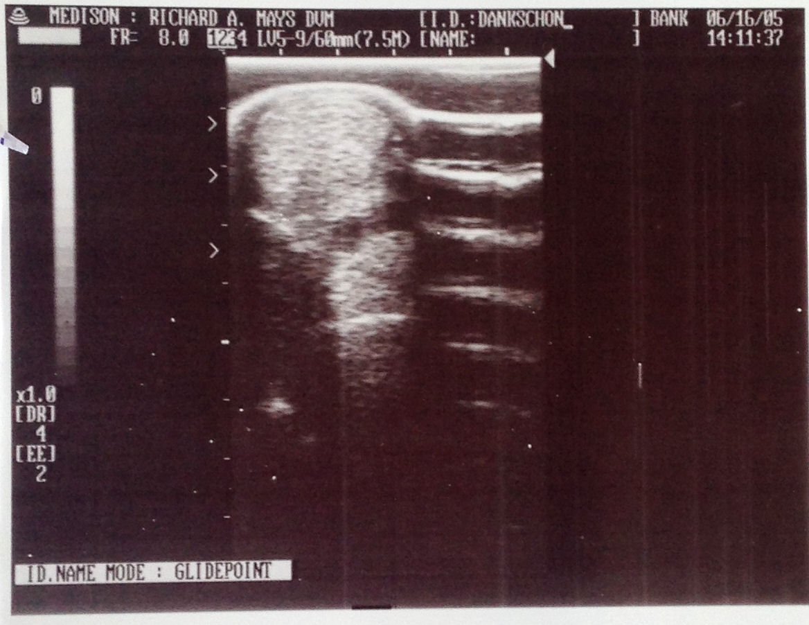 Ultrasound after the Runner's Relief routine